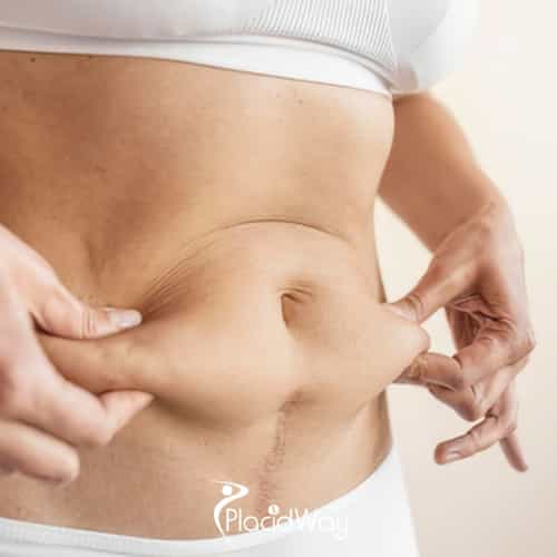Why are Specialized Hospitals the Gold Standard for Post-Baby Restoration in HCMC?